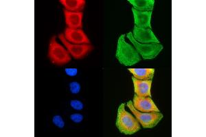 ABIN6259425 and ABIN6276230 staining Hela cells(30 min of UV treatment) by IF/ICC. (TMEM145 抗体  (N-Term))