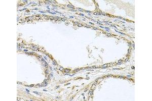 Immunohistochemistry of paraffin-embedded Human prostate using TNFRSF10A Polyclonal Antibody at dilution of 1:100 (40x lens). (TNFRSF10A 抗体)
