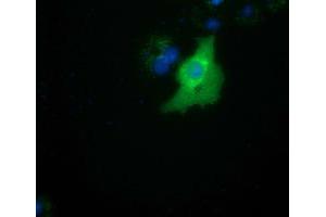 Anti-SMAD2 mouse monoclonal antibody (ABIN2453655) immunofluorescent staining of COS7 cells transiently transfected by pCMV6-ENTRY SMAD2 (RC204604). (SMAD2 抗体)