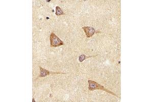 Immunohistochemistry (Paraffin-embedded Sections) (IHC (p)) image for anti-Epiregulin (EREG) (AA 137-165), (C-Term) antibody (ABIN650993)