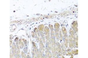Immunohistochemistry of paraffin-embedded Mouse stomach using IRS2 Polyclonal Antibody at dilution of 1:100 (40x lens). (IRS2 抗体)