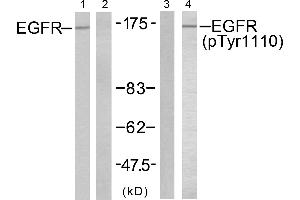 Western blot analysis of extracts from A431 cells untreated or treated with EGF (200ng/ml, 10mins), using EGFR (Ab-1110) antibody (Line 1 and 2) and EGFR (Phospho-Tyr1110) antibody (Line 3 and 4). (EGFR 抗体  (pTyr1110))
