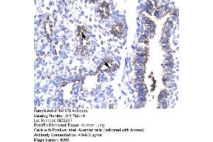 Human Lung (HIV-1 Tat Interactive Protein 2, 30kDa (HTATIP2) (N-Term) 抗体)