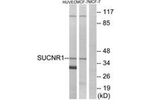 Western blot analysis of extracts from HuvEc/MCF-7 cells, using SUCNR1 Antibody. (SUCNR1 抗体  (AA 100-149))