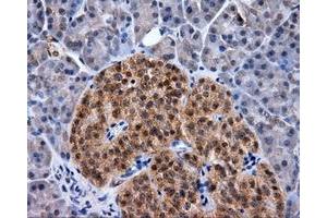 Immunohistochemical staining of paraffin-embedded Kidney tissue using anti-RC219453 mouse monoclonal antibody. (NPR3 抗体)
