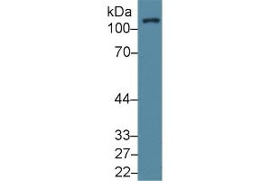 Detection of FAK in Human Lung lysate using Polyclonal Antibody to Focal Adhesion Kinase (FAK)