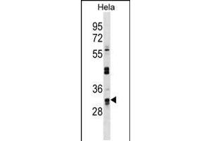 Western blot analysis in Hela cell line lysates (35ug/lane). (UTP11L 抗体  (C-Term))