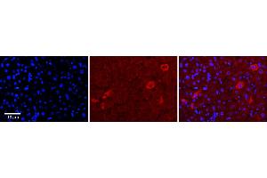 Rabbit Anti-TUSC4 Antibody      Formalin Fixed Paraffin Embedded Tissue: Human Adult Liver   Observed Staining: Cytoplasm in hepatocytes, moderate signal, very low tissue distribution  Primary Antibody Concentration: 1:100  Secondary Antibody: Donkey anti-Rabbit-Cy3  Secondary Antibody Concentration: 1:200  Magnification: 20X  Exposure Time: 0. (NPRL2 抗体  (N-Term))