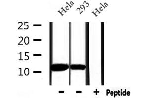 Western blot analysis of extracts from Hela and 293, using MIF Antibody. (MIF 抗体  (C-Term))