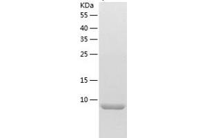 Western Blotting (WB) image for Chemokine (C-C Motif) Ligand 14 (CCL14) (AA 28-93) protein (His tag) (ABIN7287353) (CCL14 Protein (AA 28-93) (His tag))