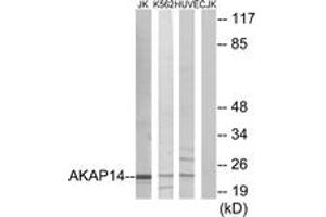 Western Blotting (WB) image for anti-A Kinase (PRKA) Anchor Protein 14 (AKAP14) (AA 1-50) antibody (ABIN2889659) (AKAP14 抗体  (AA 1-50))