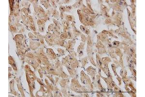 Image no. 1 for anti-Eukaryotic Translation Initiation Factor 4 gamma 2 (EIF4G2) (AA 811-890) antibody (ABIN598656) (EIF4G2 抗体  (AA 811-890))