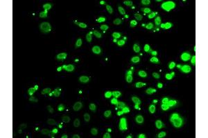 Immunofluorescence analysis of A549 cells using FIP1L1 antibody (ABIN5974293). (FIP1L1 抗体)