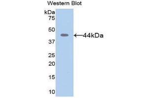 Western Blotting (WB) image for anti-Matrix Metallopeptidase 8 (Neutrophil Collagenase) (MMP8) (AA 101-467) antibody (ABIN1078309) (MMP8 抗体  (AA 101-467))