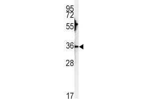 Western Blotting (WB) image for anti-Carbonic Anhydrase III (CA3) antibody (ABIN3003364) (CA3 抗体)