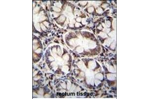 CACNG8 Antibody (N-term) (ABIN655566 and ABIN2845067) immunohistochemistry analysis in formalin fixed and paraffin embedded human rectum tissue followed by peroxidase conjugation of the secondary antibody and DAB staining.