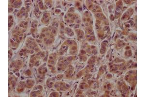 Immunohistochemistry (IHC) image for anti-Activating Transcription Factor 4 (Tax-Responsive Enhancer Element B67) (ATF4) (AA 20-200) antibody (ABIN7148793)