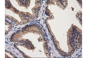 Image no. 8 for anti-Glucosidase, Beta, Acid 3 (Cytosolic) (GBA3) (AA 1-150), (AA 370-469) antibody (ABIN1490582)