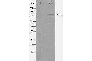 Western blot analysis of Integrin αV expression in HeLa cells,The lane on the left is treated with the antigen-specific peptide. (CD51 抗体  (Internal Region))