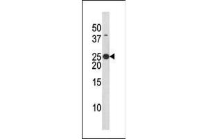 The anti-Phospho-Bad- Pab (ABIN389519 and ABIN2839570) is used in Western blot to detect Phospho-Bad- in HL60 tissue lysate (BAD 抗体  (pSer134))