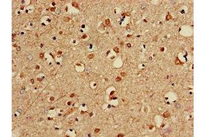 Immunohistochemistry of paraffin-embedded human brain tissue using ABIN7169270 at dilution of 1:100