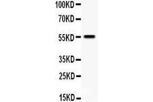 Anti- TFPI antibody, Western blotting All lanes: Anti TFPI  at 0. (TFPI 抗体  (N-Term))