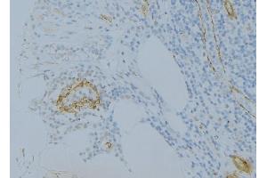 ABIN6275032 at 1/100 staining Human uterus tissue by IHC-P. (C1S 抗体  (C-Term))