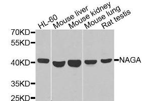 Western blot analysis of extracts of various cell lines, using NAGA antibody. (NAGA 抗体  (AA 312-411))