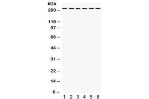 Western blot testing of 1) rat liver, 2) rat kidney, human 3) Jurkat, 4) 22RV1, 5) HepG2, 6) SMMC lysate with Integrin alpha 4 antibody. (ITGA4 抗体)