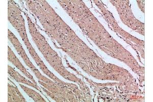 Immunohistochemistry (IHC) image for anti-Phosphoinositide 3 Kinase, p85 beta (PI3K p85b) (AA 1-60) antibody (ABIN7189409)