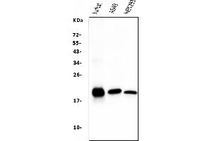 Western blot analysis of Bid using anti-Bid antibody (ABIN7599062).