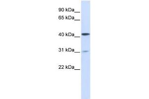 TMPRSS11D antibody used at 1 ug/ml to detect target protein. (TMPRSS11D 抗体  (Middle Region))