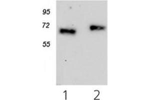 Western Blotting (WB) image for anti-Cytokine Receptor-Like Factor 2 (CRLF2) antibody (ABIN1106837) (CRLF2 抗体)