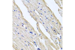 Immunohistochemistry of paraffin-embedded rat heart using RCN2 antibody at dilution of 1:100 (x40 lens). (RCN2 抗体)