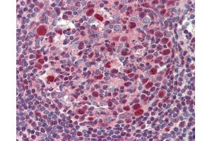 Immunohistochemistry (IHC) image for anti-B-Cell CLL/lymphoma 6 (BCL6) (Internal Region) antibody (ABIN2855012)
