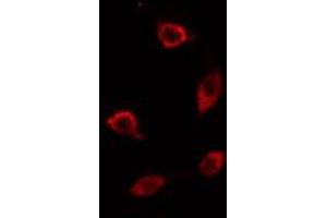 ABIN6274467 staining HT29 cells by IF/ICC. (PMEPA1 抗体  (Internal Region))