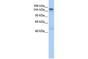 WB Suggested Anti-TEX14 Antibody Titration: 0. (TEX14 抗体  (C-Term))