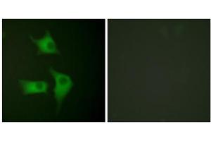 Immunofluorescence analysis of HeLa cells, using p15 INK antibody (ABIN5976476). (CDKN2B 抗体  (C-Term))