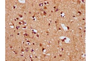 IHC image of ABIN7169865 diluted at 1:200 and staining in paraffin-embedded human brain tissue performed on a Leica BondTM system.