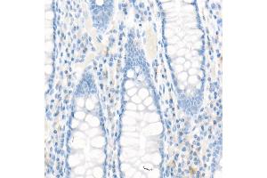 Immunohistochemistry of paraffin-embedded Human colon using MRP1/ antibody (ABIN7265736) at dilution of 1:100 (40x lens). (ABCC1 抗体)