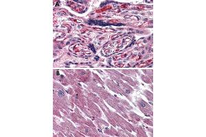 Immunohistochemical staining of formalin-fixed, paraffin-embedded human placenta (A) and human heart (B) tissue after heat-induced antigen retrieval. (ADCYAP1R1 抗体  (Extracellular Domain))