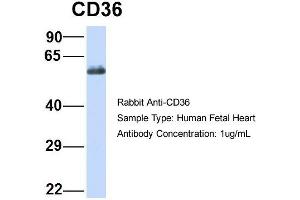 Host:  Rabbit  Target Name:  CD36  Sample Type:  Human Fetal Heart  Antibody Dilution:  1. (CD36 抗体  (N-Term))