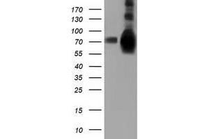 HEK293T cells were transfected with the pCMV6-ENTRY control (Left lane) or pCMV6-ENTRY HSPA6 (Right lane) cDNA for 48 hrs and lysed. (HSPA6 抗体)