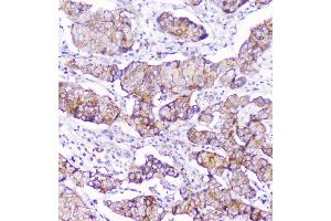 IHC analysis of CD2AP using anti-CD2AP antibody (ABIN6719544).