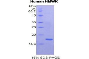 SDS-PAGE (SDS) image for Kininogen (High Molecular Weight) (AA 58-176) protein (His tag) (ABIN1877392) (Kininogen (HMW) Protein (AA 58-176) (His tag))