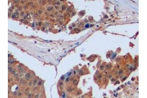 Immunohistochemistry (IHC) image for anti-Isocitrate Dehydrogenase 1 (NADP+), Soluble (IDH1) (AA 74-333) antibody (ABIN7436579)