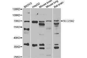 Western blot analysis of extracts of various cell lines, using SLC23A2 antibody (ABIN5974077) at 1/1000 dilution. (SLC23A2 抗体)