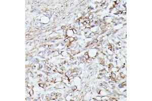 Immunohistochemistry (IHC) image for anti-Acetyl-CoA Acetyltransferase 2 (ACAT2) (AA 1-97) antibody (ABIN6136417)