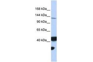 Image no. 1 for anti-MutL Homolog 3 (MLH3) (AA 1188-1237) antibody (ABIN6743100) (MLH3 抗体  (AA 1188-1237))