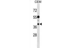Western Blotting (WB) image for anti-Tumor Suppressing Subtransferable Candidate 1 (TSSC1) antibody (ABIN2999073) (TSSC1 抗体)